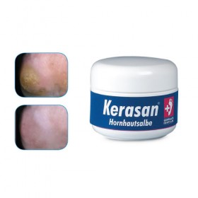 Kerasan cornea salve 50g